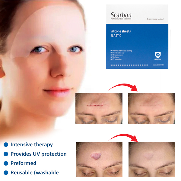 ScarBan-Elastic-Silicone-Sheets-Forehead-11-r Scarban Elastic Silicone Sheets Forehead - Image 1