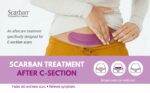 Scarban C-Section Recovery Kit - Image 3