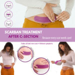 Scarban C-Section Recovery Kit